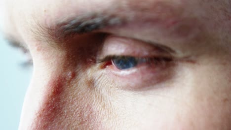 close-up of patient eye