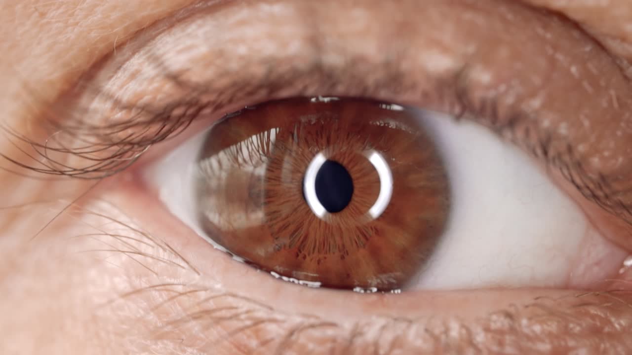 mujer con un solo ojo de cerca