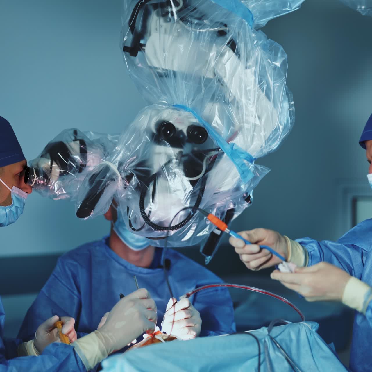 Neurosurgical team performing operation with usage of technological equipment. Doctors operate the patient looking at microscope and assistant cleaning the instrument