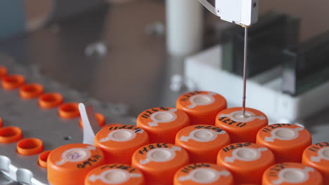 in the medical center, the machine analyzes the bio material for the presence of cancer cells in patients who underwent a puncture