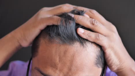 man with hand on head, possible hair loss