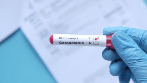 coronavirus blood test