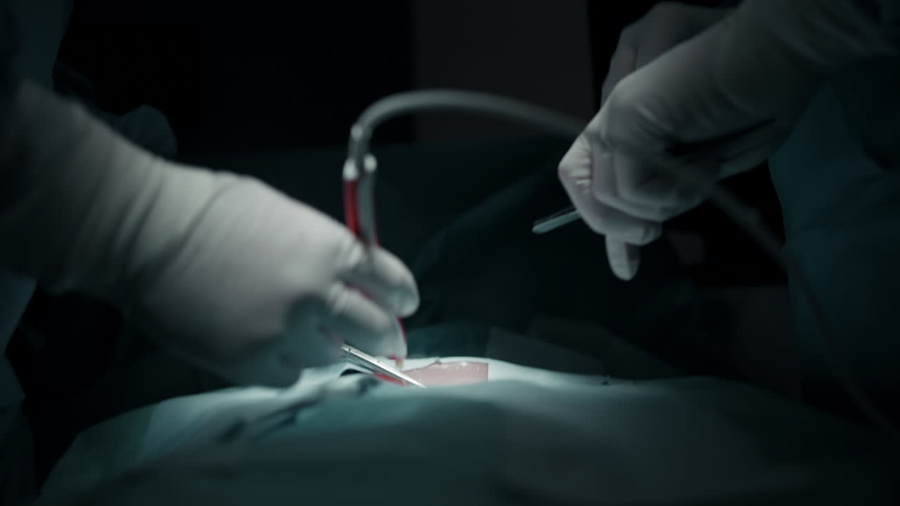 Surgical Procedure