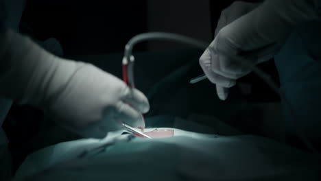 surgical procedure