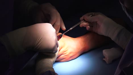 the act of performing surgery may be called a surgical procedure, operation, or simply "surgery