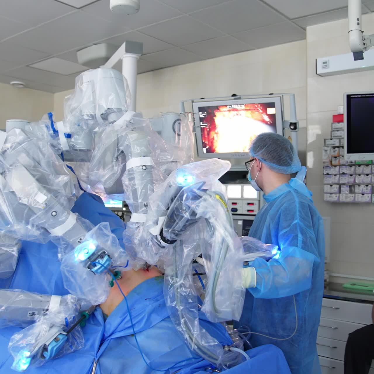 Male surgeon controlling the work of Da Vinci robot at operation on patient. Robotic arms input into body on operating table. Medical staff watching the surgery