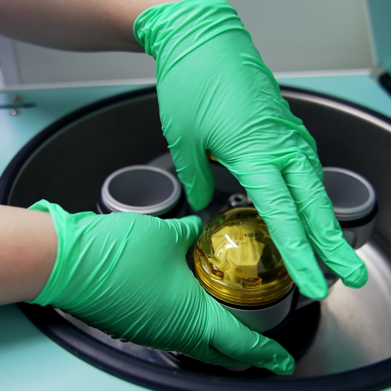 Hands in latex gloves uncover the tops on little reservoirs. Equipment for receiving blood plasma close up