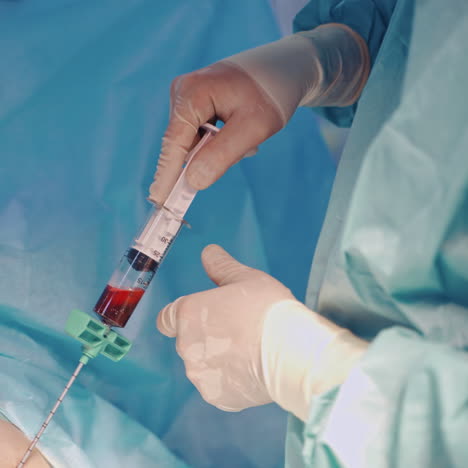stem cell treatment. platelet rich plasma - prp. biological therapies.