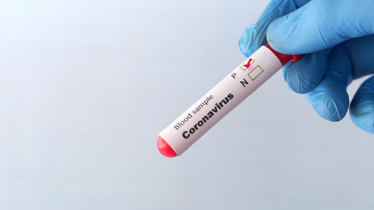 Campione di sangue per il test del Coronavirus