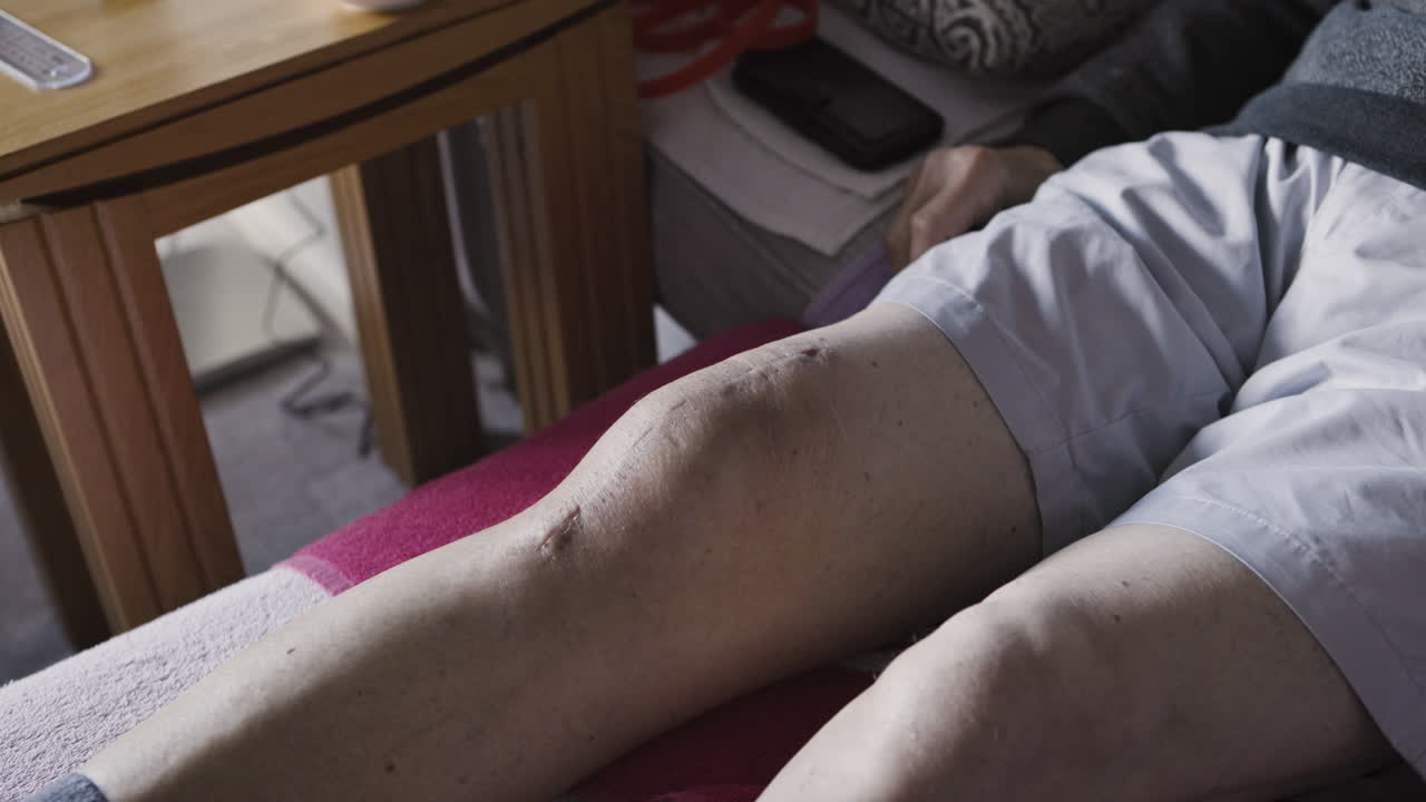 Elderly man with knee scar sitting on couch