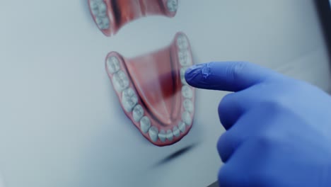 dentist examining teeth on a digital image