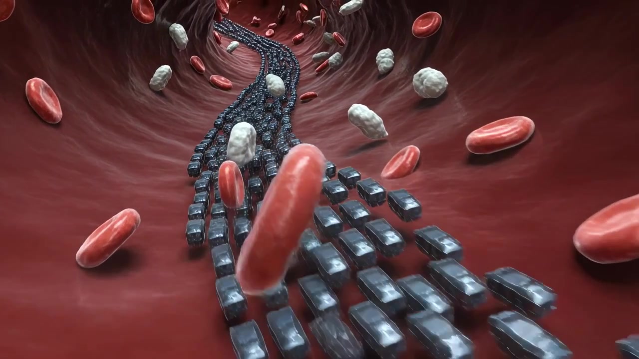 Blood flow pushing metallic ribbon in vessel lumen passing red cells and white cells carrying drug