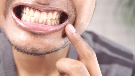 man checking his teeth