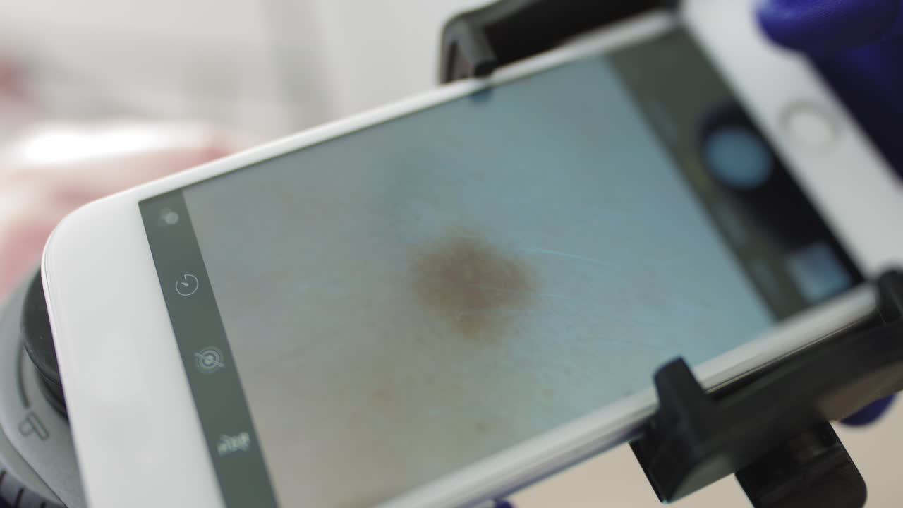 Un médico profesional, dermatólogo, investiga una marca de nacimiento en el teléfono conectado a un dispositivo especial