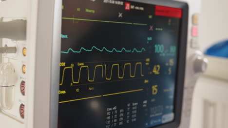 medical monitor displaying vital signs