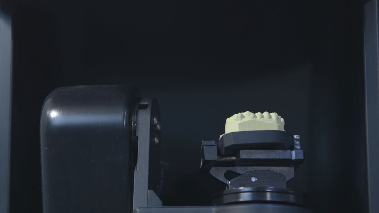 3D Scanning of a Dental Model