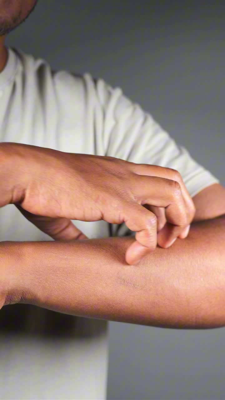 Primer plano de una persona rascándose el brazo con picazón