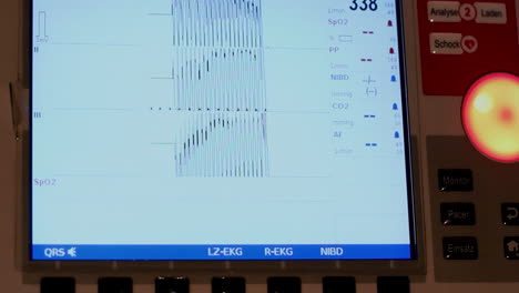 ekg showing a flatline, indicating heart failure in the hospital