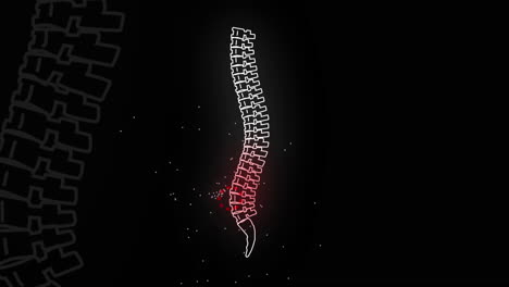 illustration of a spine with back pain
