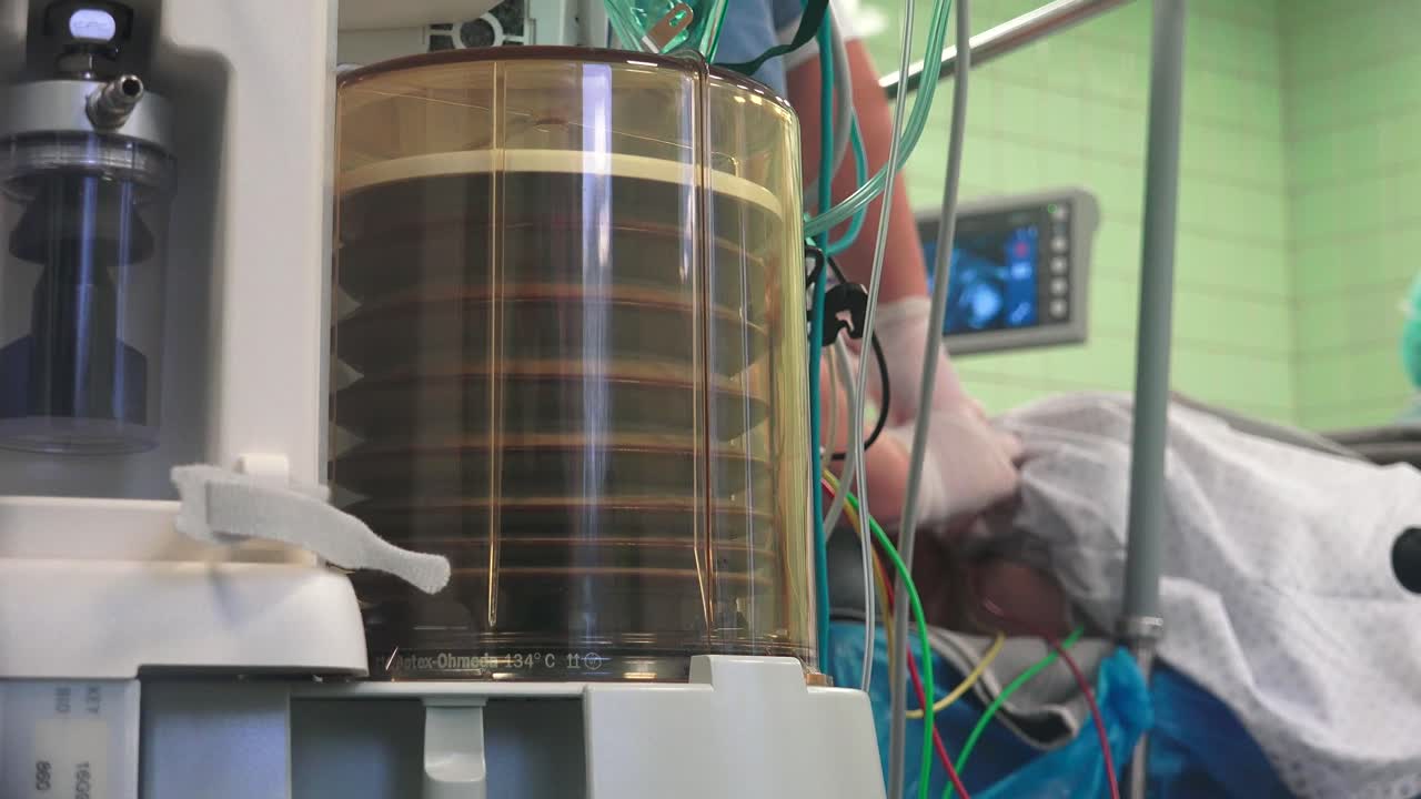 의료용 인공호흡기는 물리적으로 숨을 쉴 수 없는 환자에게 호흡을 제공하기 위해 호흡할 수 있는 공기를 폐 안팎으로 이동시키도록 설계된 기계인 기계식 인공호흡기입니다.