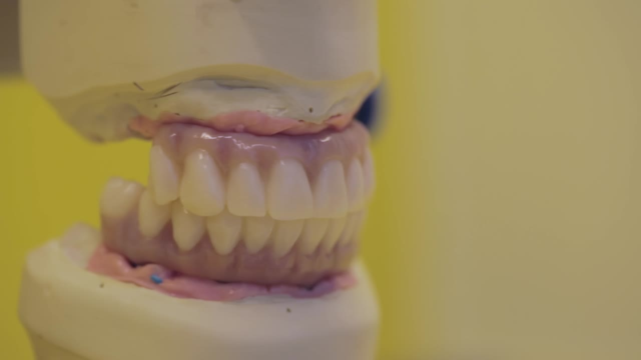 Dental prosthetic with upper and lower sets of teeth being adjusted on a dental model
