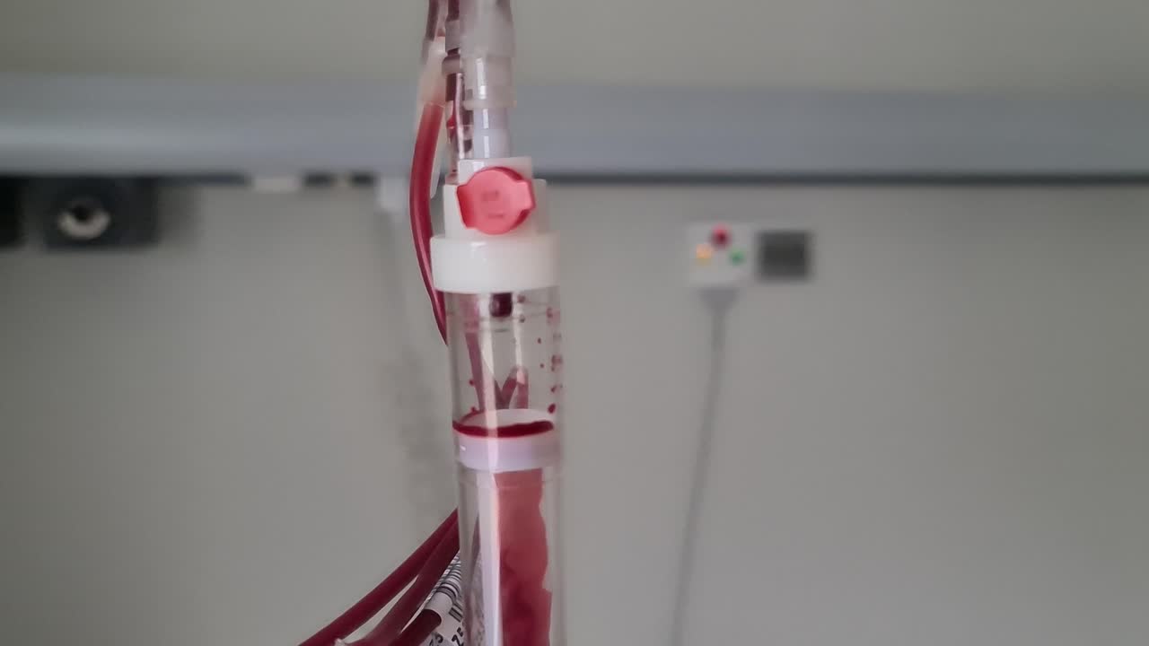 Close-up of a Blood IV Drip in a Hospital Setting