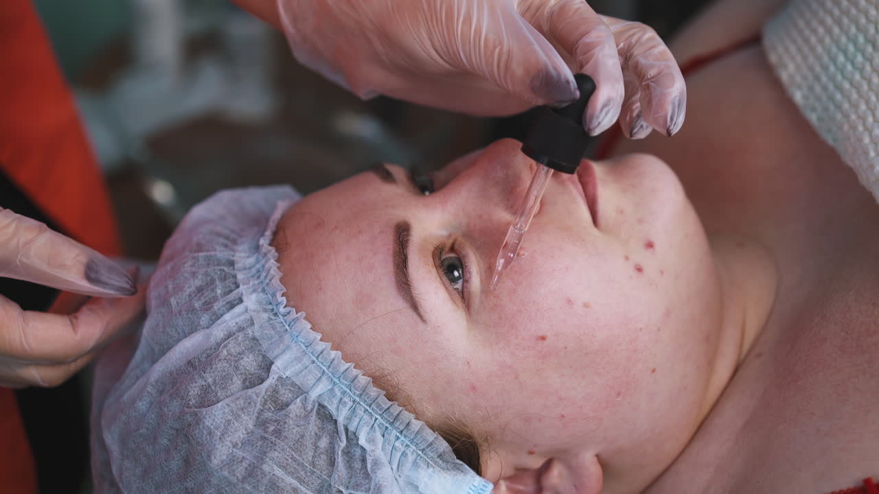 il cosmetologo applica il liquido sul viso della donna con una pipetta