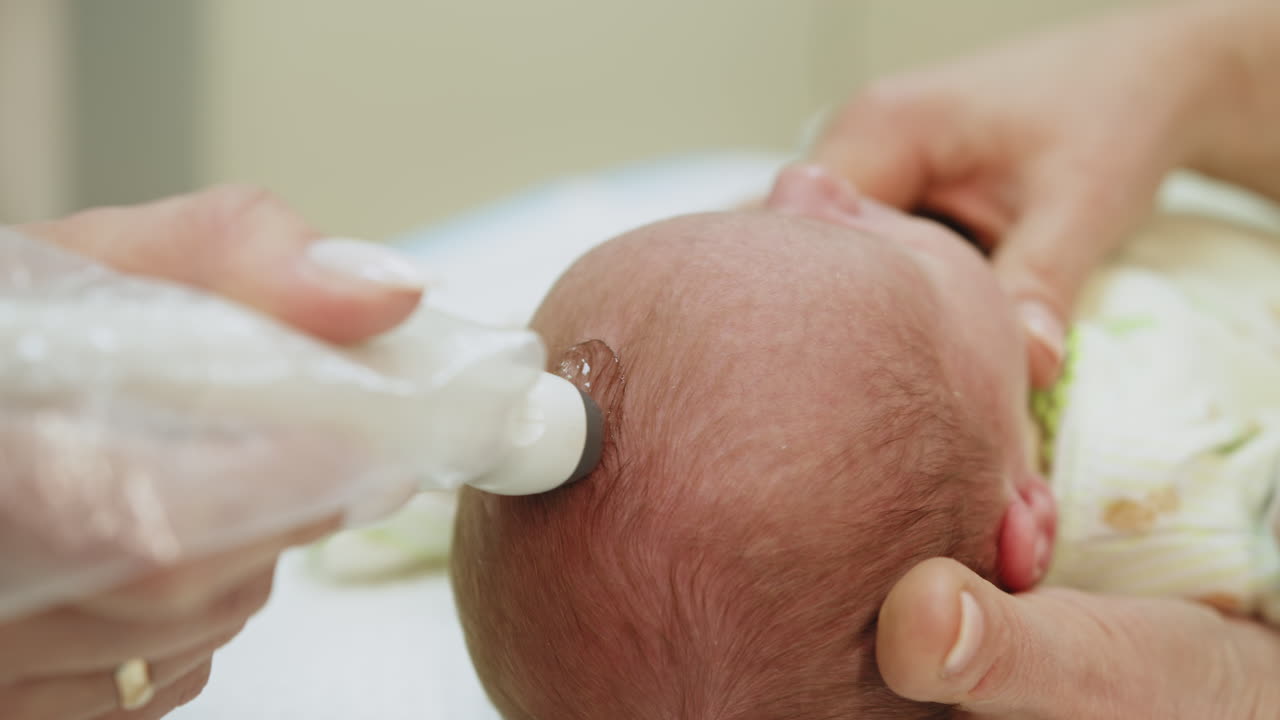 Baby undergoing cranial ultrasound