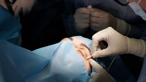 blepharoplasty plastic surgery operation, focused on rejuvenation and modification of the eye region.