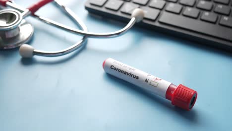 coronavirus blood sample test with medical equipment
