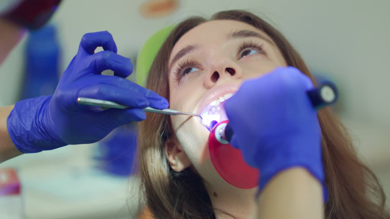 Whitening of tooth filling material. Close up dentist doing procedure