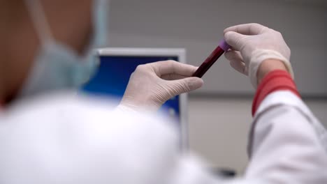 doctor with blood test in tube in laboratory