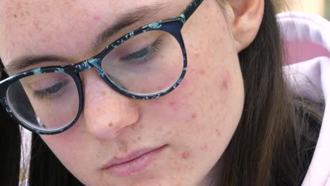 joven con gafas y la cara cubierta de acné mira hacia abajo, sintiendo vergüenza