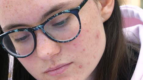 young girl with glasses and the face covered in acne looks down, feeling shame