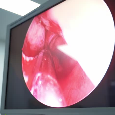 operation with surgery equipment