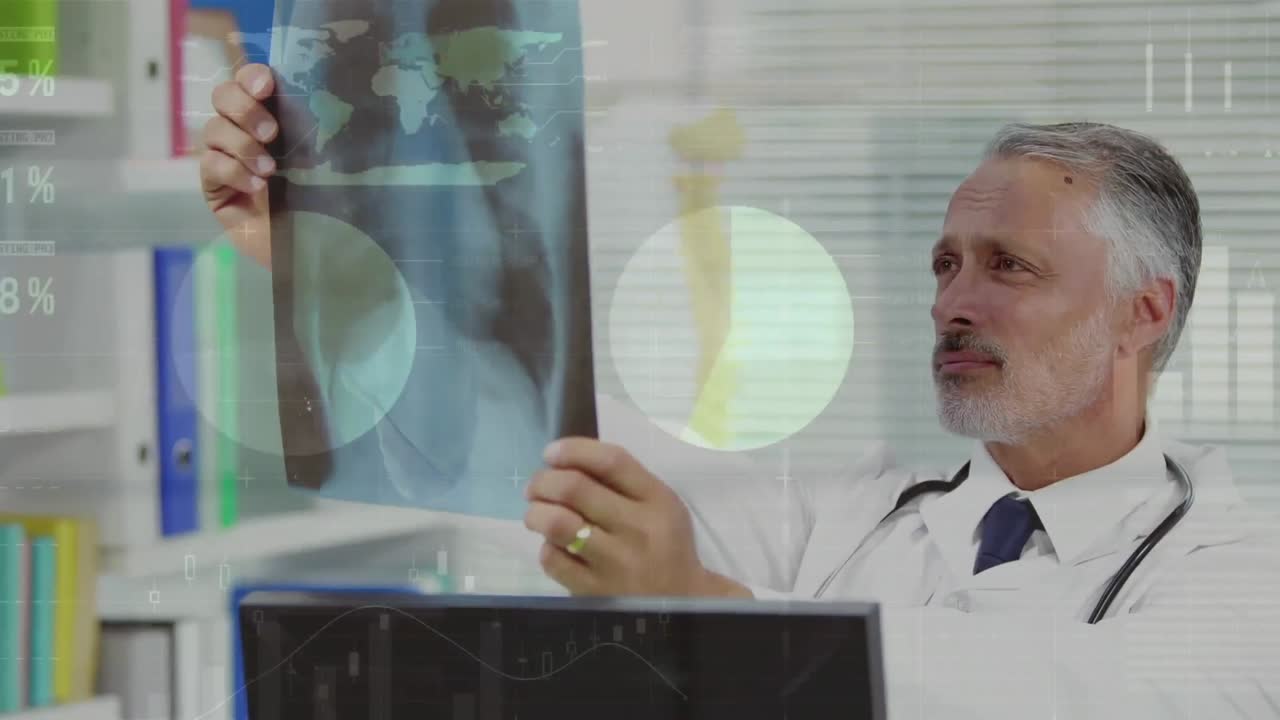 animación del procesamiento de datos estadísticos sobre un médico caucásico examinando radiografías en el hospital