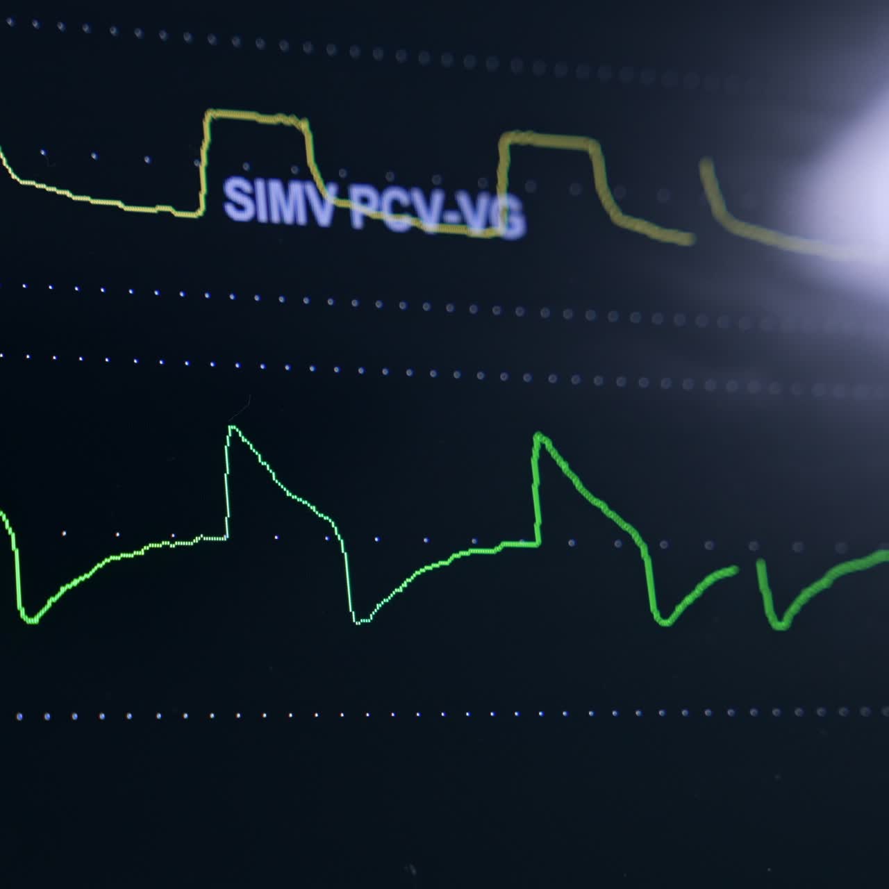Curved lines running on the black screen of medical equipment. Close up