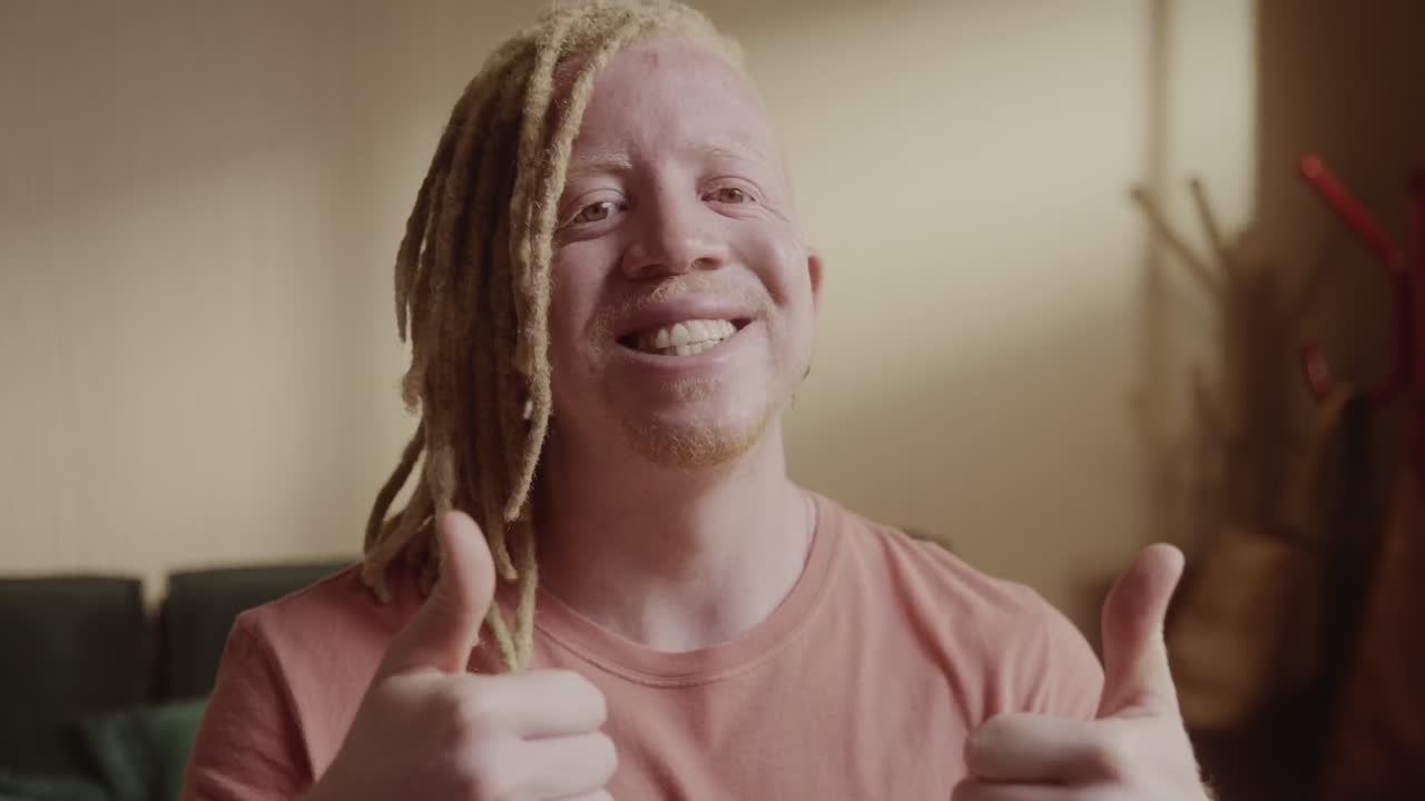 Man with albinism and dreadlocks giving thumbs up