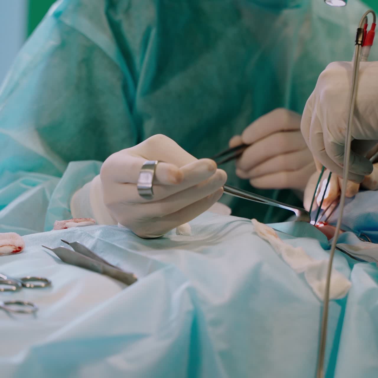 Surgical procedure. Hands in gloves performing an operation on a patient using surgical tools. Medical instruments. Close-up.