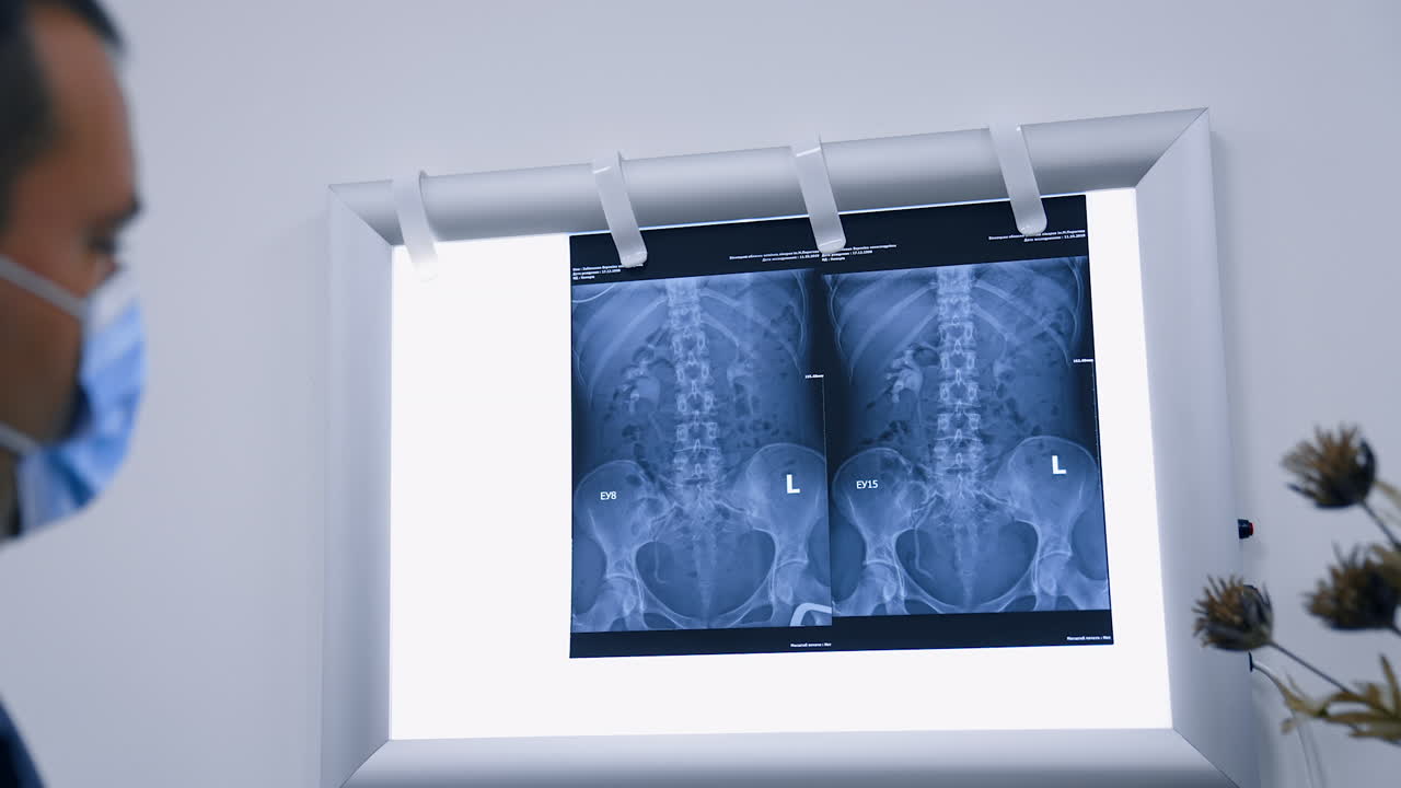 Two x-ray scan of inner organs on the light screen. Doctor's hand pointing at shots with a pen explaining the problem.