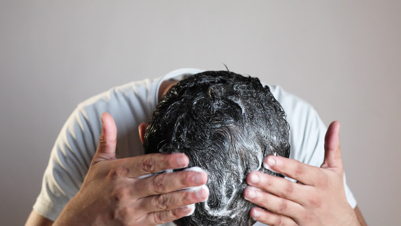 man using minoxidil foam for hair loss treatment, apply shampoo on scalp