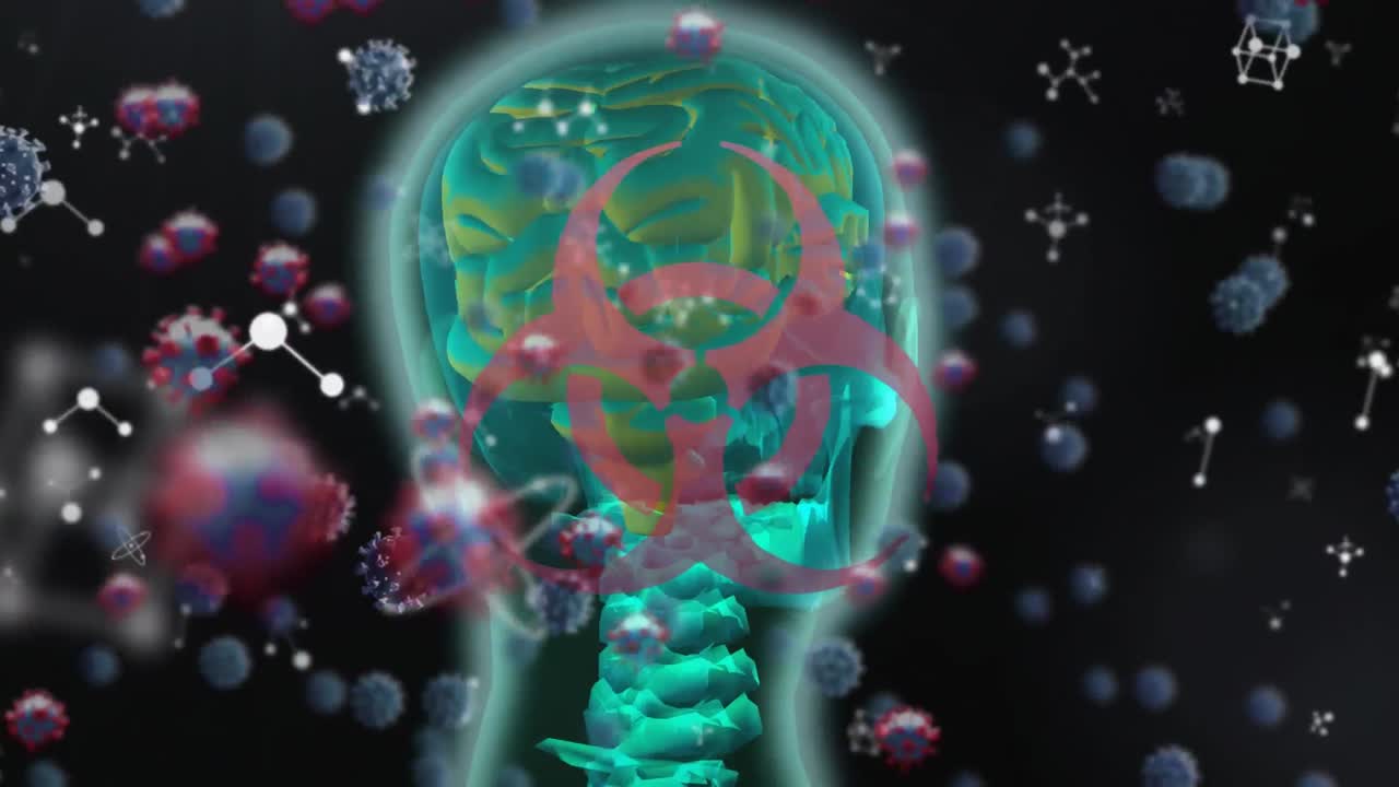 인간 몸의 골격에 퍼지는 거대 코로나바이러스 코로나19 세포의 애니메이션