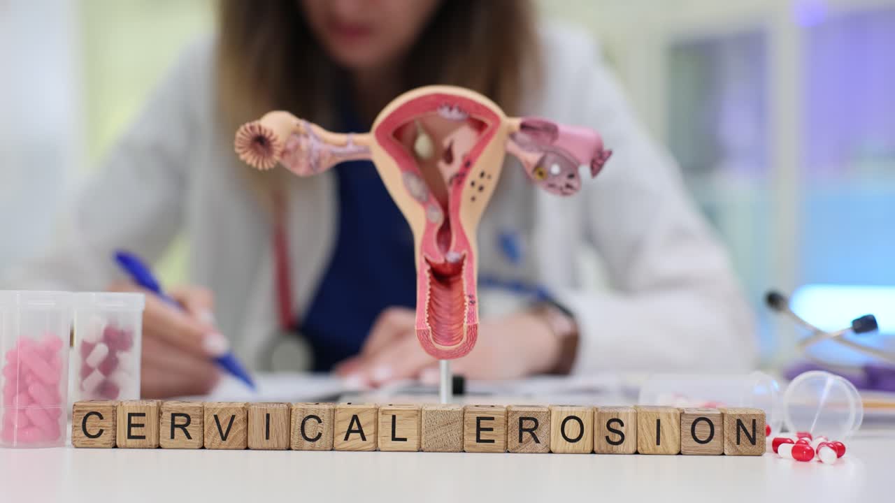 Cubi di legno formano la frase erosione cervicale vicino a un modello di utero