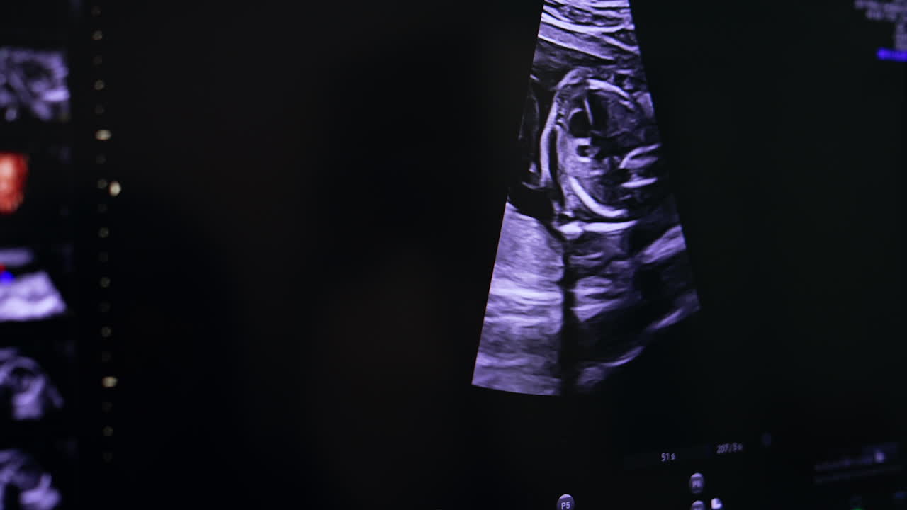 Ultrasound scanning of pregnancy. Checking up the development of a baby before birth.