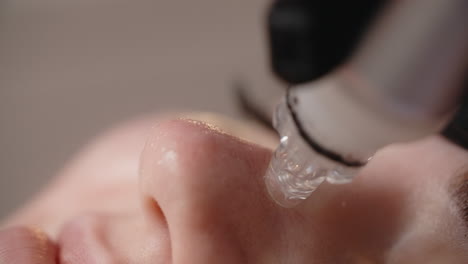 microdermabrasion facial treatment