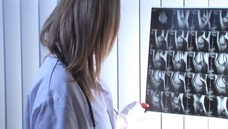 stock footage of nurse with xray scan