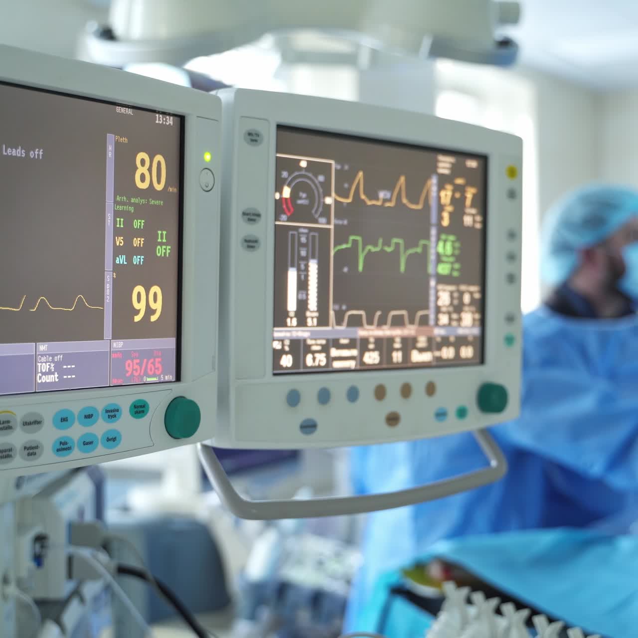 Monitor medico reale che mostra i segni vitali durante un intervento chirurgico. Grafica dell'attività elettrica del battito cardiaco e della pressione sanguigna del paziente. Primo piano
