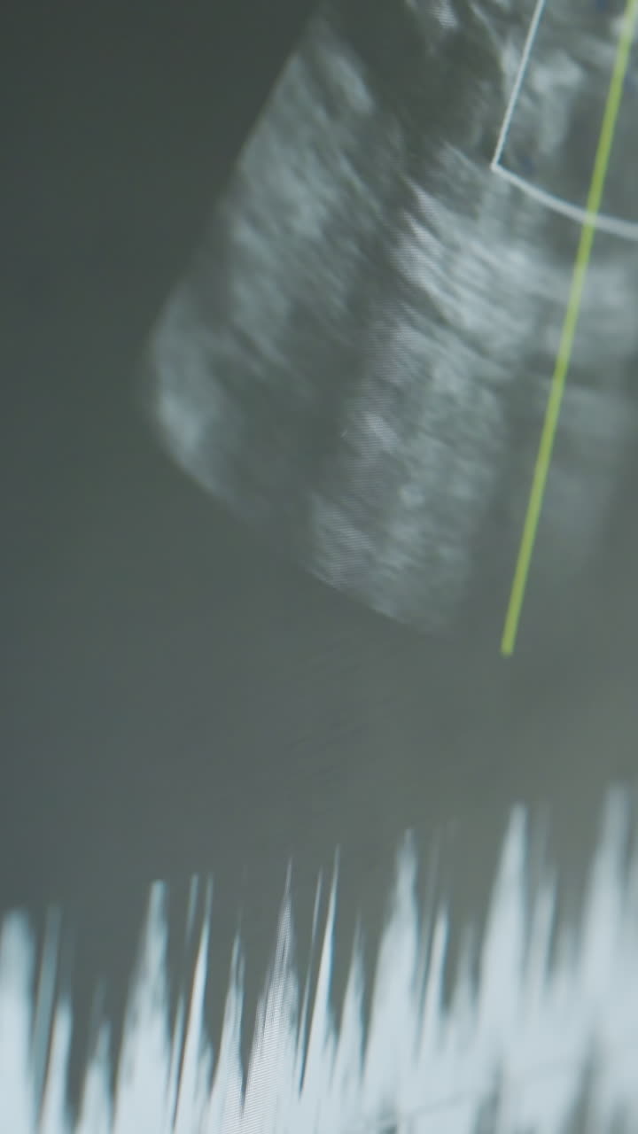color Doppler ultrasound showing blood flow with red and blue mapping on screen, spectral Doppler peaks and velocity tracings visible while sonographer and cardiologist review hemodynamic patterns