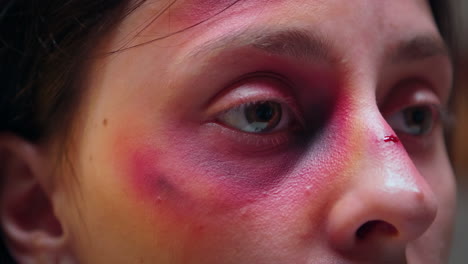 Primer-Plano-De-La-Cara-Con-Hematoma