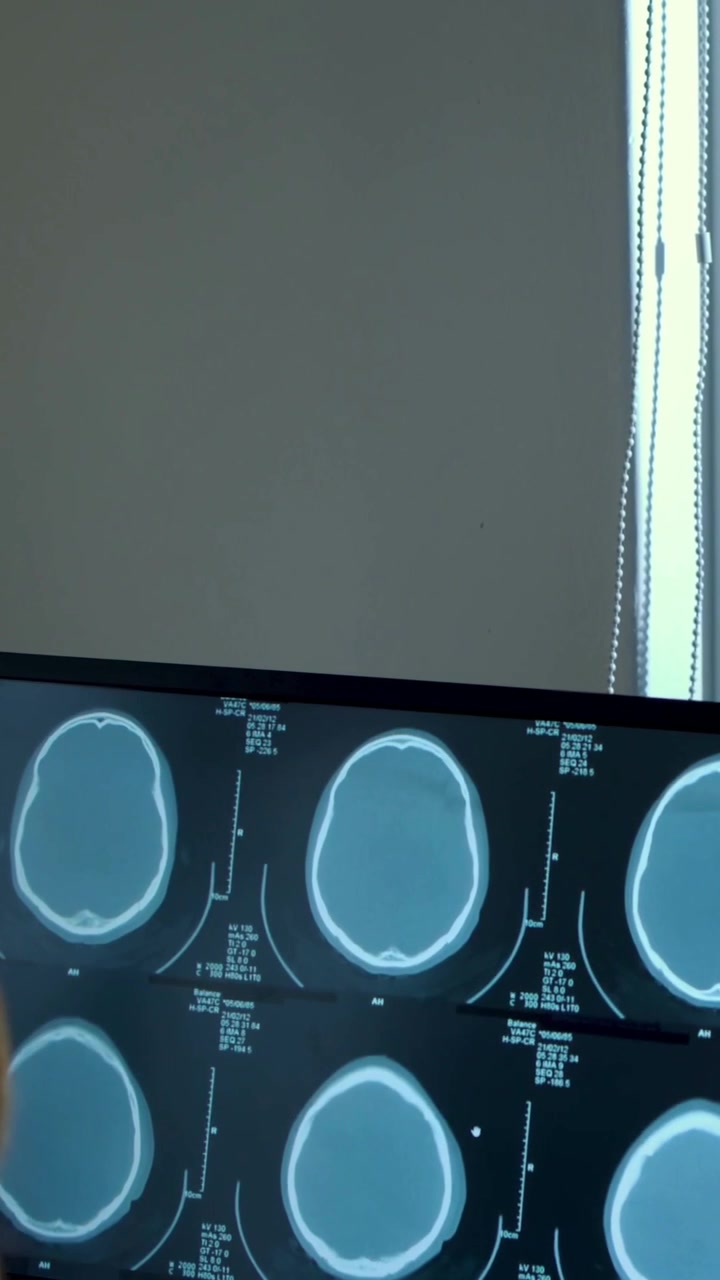 Video verticale: Dito che entra, indica e sfoglia le sezioni di TAC cerebrale su un monitor in clinica per la revisione.